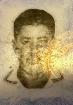 Doktorun Sedye Üstünde Kalp Masajıyla Kurtardığı Adam Hayatını Kaybetti